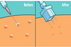 “水光补水”效果能维持多久?