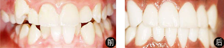 美丽种草前后对比照